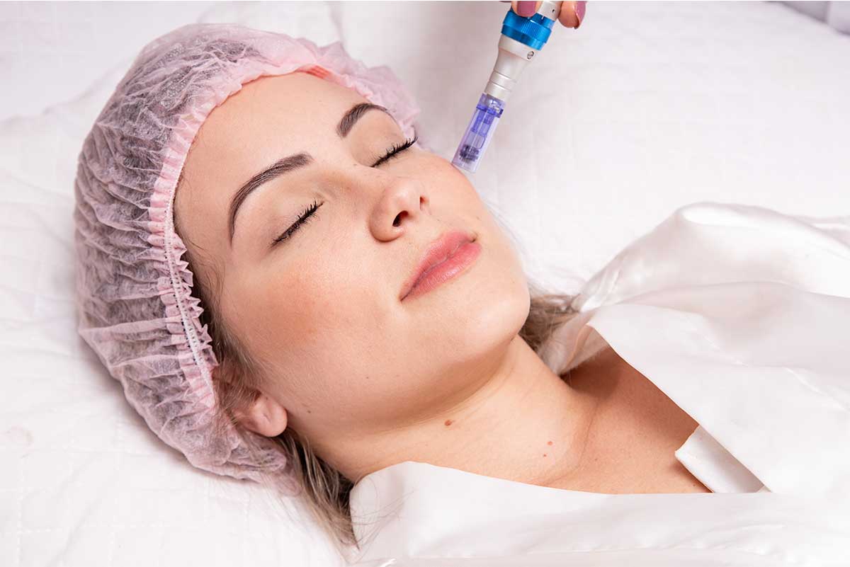 Microneedling Wien, Microneedling Wien 1100, Schönheitssalon 1100 Wien