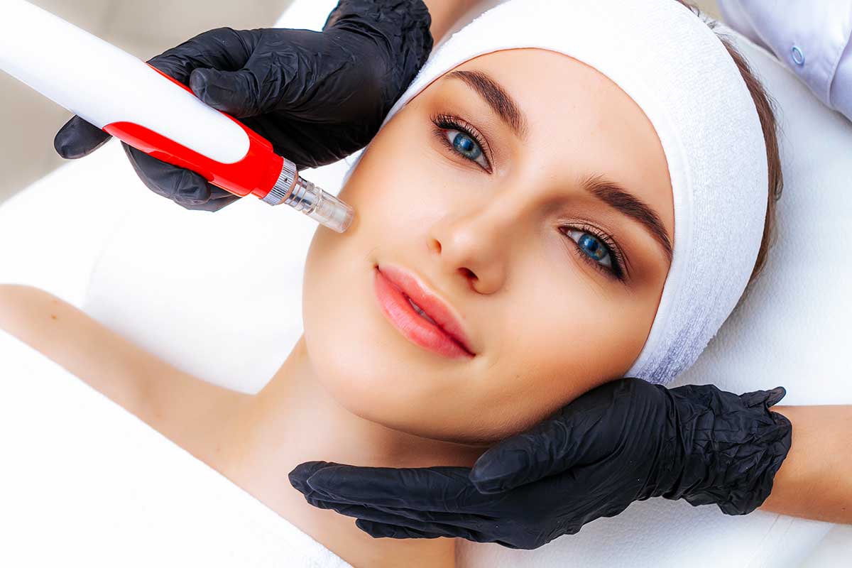 Microneedling pen, Microneedling Falten, Dermapen Behandlung
